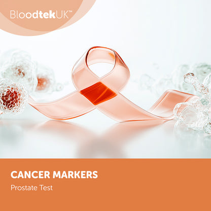 Prostate test