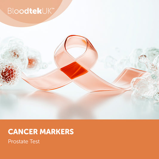 Prostate test
